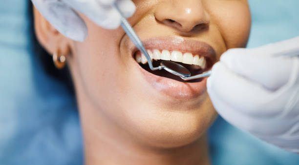 Best Emergency Tooth Extraction in Wrightsville, GA