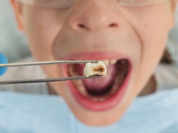 Best Same-Day Emergency Dental Services in Wrightsville, GA